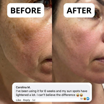 Serivalo™ LumiFirm 3-in-1 Cream