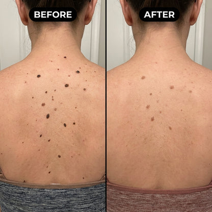 Serivalo™ Glycolic Acid Exfoliating Body Stick